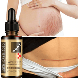 3pcs Essential Massage oils Scar Removal Lavender Oil Pregnant Women Hyaluronic - Khalesexx