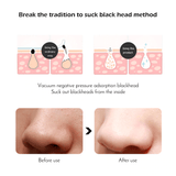 Khalesexx Face Acne Black Dot Pimple Blackhead Remover Electric Microcrystalline Skin Care