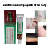 1pcs Shima ointment is used for local treatment of...