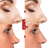 Khalesexx Nose Lifting Up Essence Oil Tightening Beauty Nose Care Massage Reduce Narrow