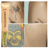 Khalesexx Permanent Tattoo Removal Cream Tattoo Print Cleaning Cream Applicable Accesories