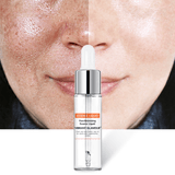 Khalesexx Shrink Pores Face Serum Whitening Hyaluronic Acid Liquid Moisturizing Skin Care