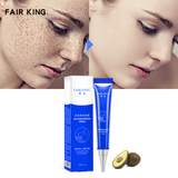 Effective Whitening Freckle Cream 20g Moisturizing Remove Melasma Acne Spots - Pornhint